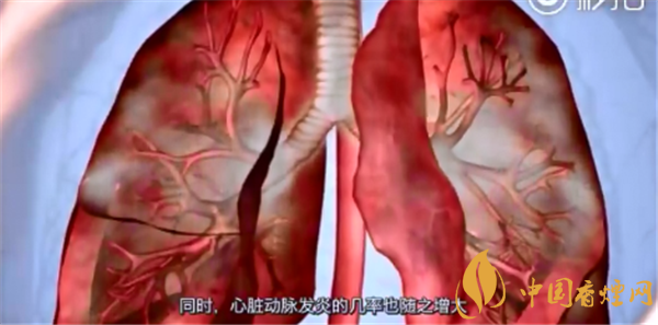 吸煙與肺癌的關系研究 與吸煙關系最為密切的肺癌是鱗癌